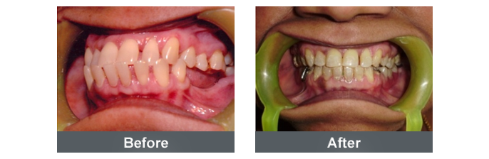 Orthodontics Image - 4